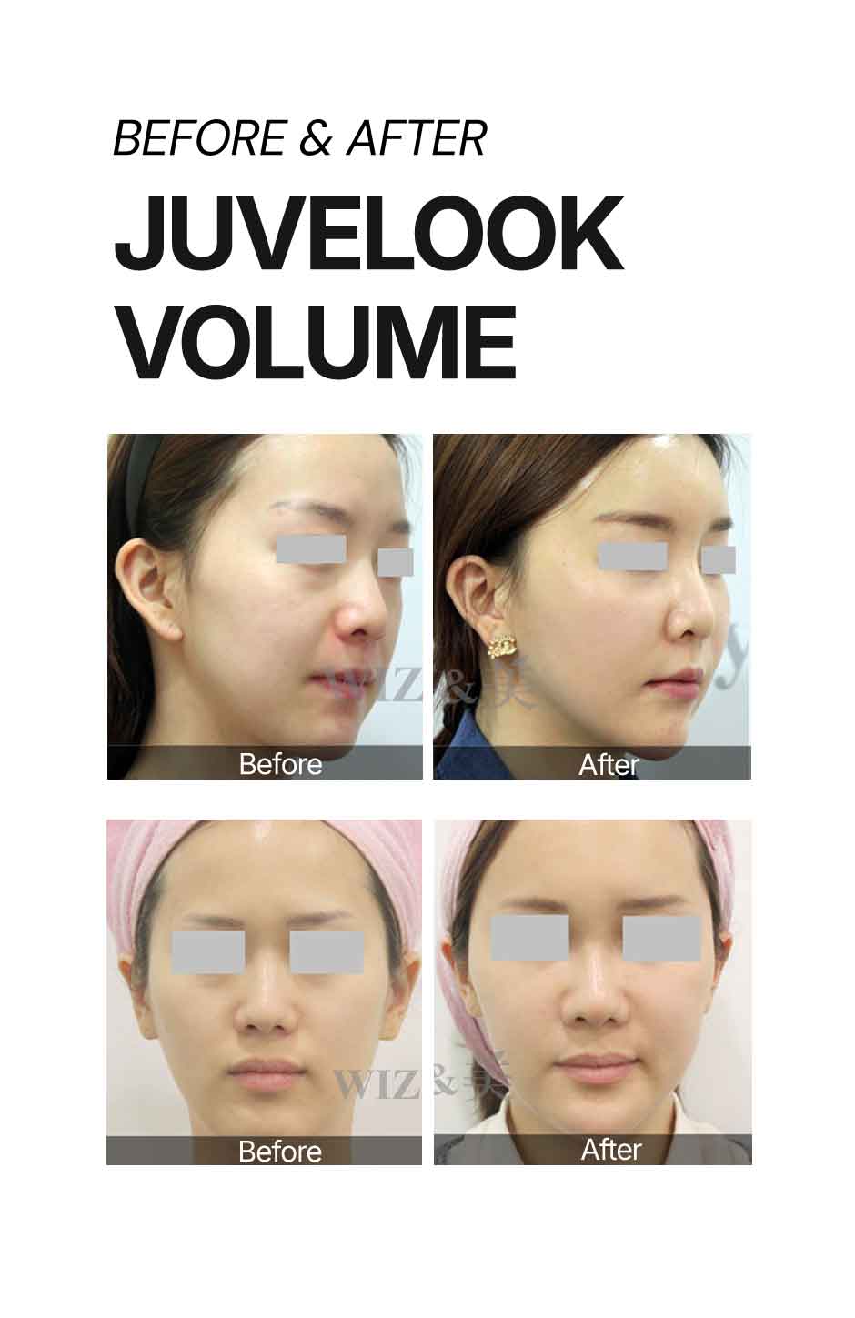 위즈앤미_쥬베룩볼륨1_10.jpg