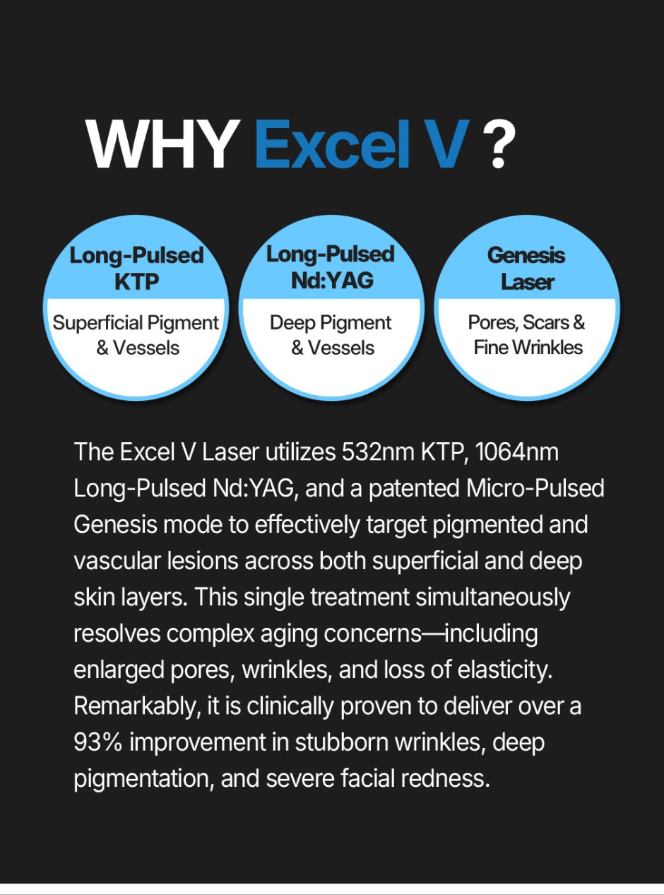 엑셀V+피코토닝_05.jpg